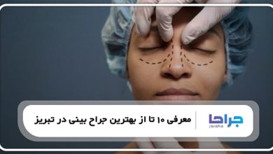 بهترین جراح بینی در تبریز