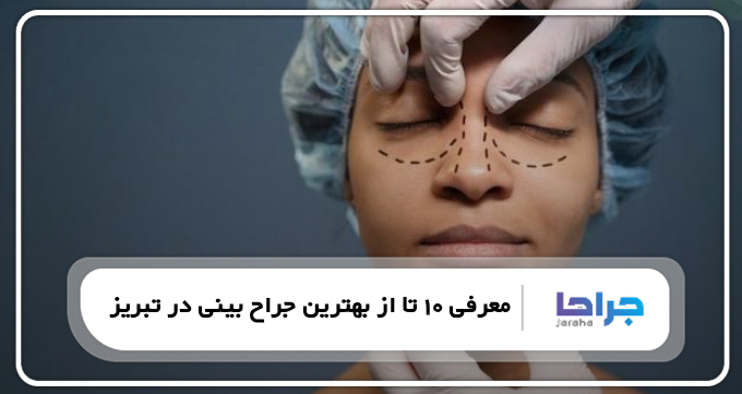 بهترین جراح بینی در تبریز