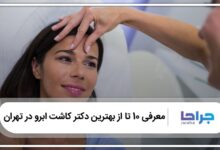 بهترین دکتر کاشت ابرو در تهران