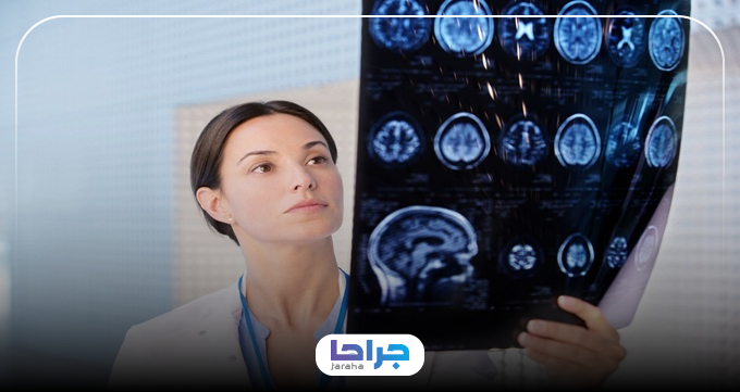 چه افرادی باید به بهترین پزشکان مغز و اعصاب در تهران مراجعه کنند؟