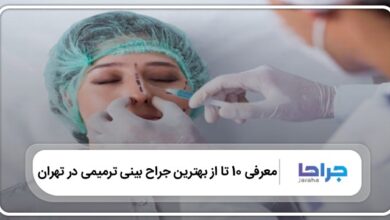 بهترین جراح بینی ترمیمی در تهران