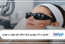 بهترین مرکز اسکار جای جوش در تهران