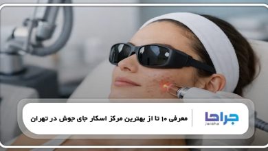 بهترین مرکز اسکار جای جوش در تهران