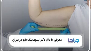 بهترین دکتر لیپوماتیک بازو در تهران