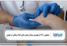 بهترین مرکز درمان جای آبله مرغان در تهران