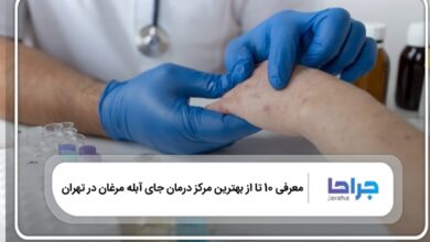بهترین مرکز درمان جای آبله مرغان در تهران