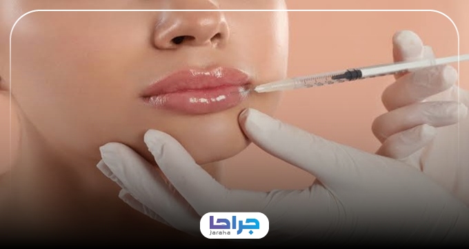 بایدها و نبایدهای بعد از تزریق ژل لب