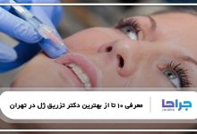 بهترین دکتر تزریق ژل در تهران