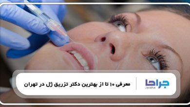 بهترین دکتر تزریق ژل در تهران
