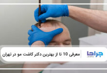 بهترین دکتر کاشت مو در تهران