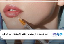 بهترین دکتر تزریق ژل در تهران