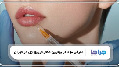 بهترین دکتر تزریق ژل در تهران