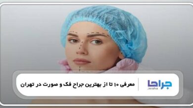 بهترین جراح فک و صورت در تهران