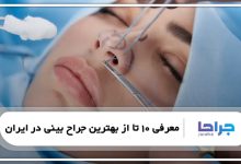 معرفی 10 تا از بهترین جراح بینی در ایران