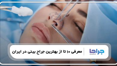 معرفی 10 تا از بهترین جراح بینی در ایران