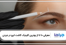 بهترین کلینیک کاشت ابرو در جردن