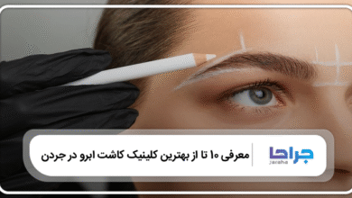 بهترین کلینیک کاشت ابرو در جردن
