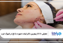 بهترین دکتر لیفت صورت با نخ در شهرک غرب