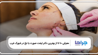 بهترین دکتر لیفت صورت با نخ در شهرک غرب