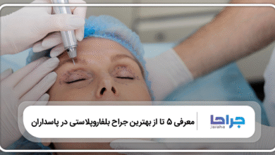 بهترین جراح بلفاروپلاستی در پاسداران