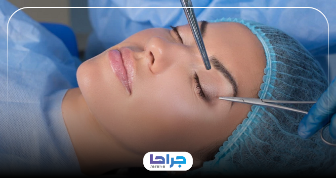 عمل بلفاروپلاستی برای چه افرادی مناسب است؟