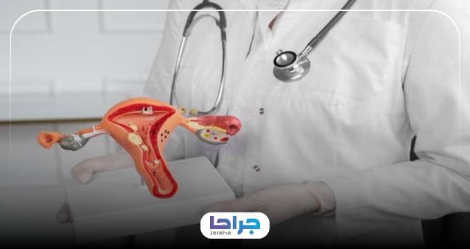 هزینه عمل اندومتریوز توسط بهترین جراح اندومتریوز در تهران