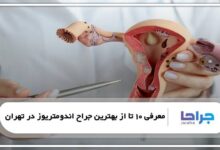 بهترین جراح اندومتریوز در تهران