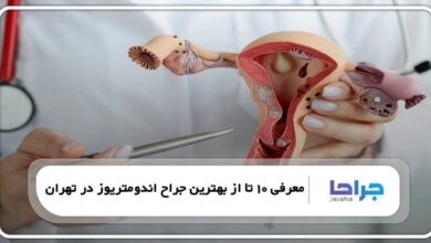 بهترین جراح اندومتریوز در تهران