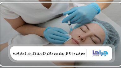 بهترین دکتر تزریق ژل در زعفرانیه