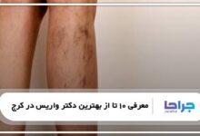 بهترین دکتر واریس در کرج