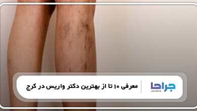 بهترین دکتر واریس در کرج