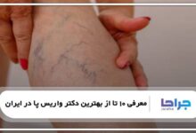 بهترین دکتر واریس پا در ایران