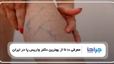 بهترین دکتر واریس پا در ایران