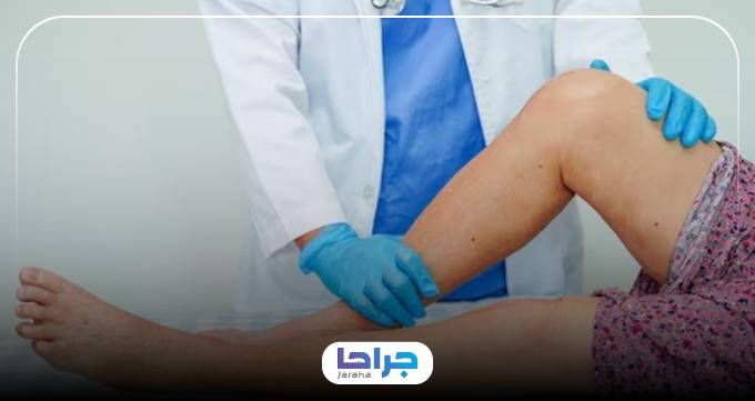 اهمیت دریافت مشاوره از بهترین دکتر واریس پا در کرج