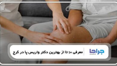 بهترین دکتر واریس پا در کرج