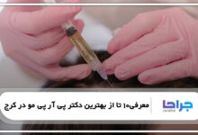 معرفی10 تا از بهترین دکتر پی آر پی مو در کرج
