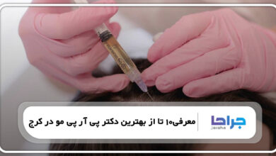 معرفی10 تا از بهترین دکتر پی آر پی مو در کرج