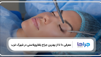 بهترین جراح بلفاروپلاستی در شهرک غرب