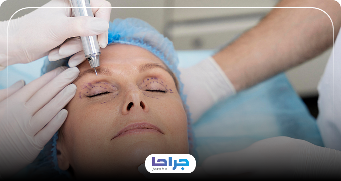 مهمترین اقدامات قبل از جراحی بلفاروپلاستی