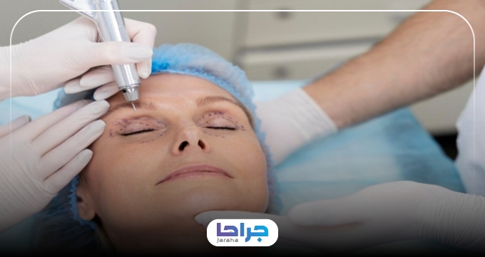 هزینه خدمات بهترین جراح چشم گربهای در زعفرانیه