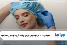 بهترین جراح چشم گربهای در زعفرانیه