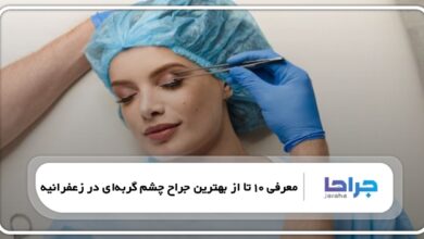 بهترین جراح چشم گربهای در زعفرانیه