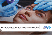 بهترین دکتر تزریق فیلر زیر چشم در صادقیه