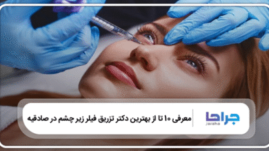 بهترین دکتر تزریق فیلر زیر چشم در صادقیه