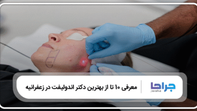 بهترین دکتر اندولیفت در زعفرانیه
