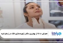 بهترین دکتر زاویهسازی فک در زعفرانیه