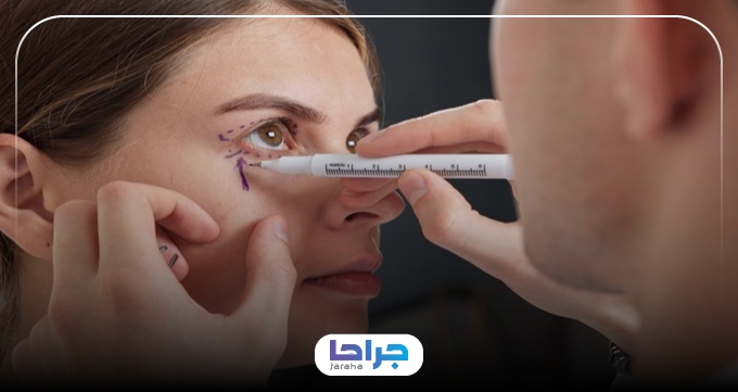 چه کسانی کاندیدای مناسب بلفاروپلاستی هستند؟