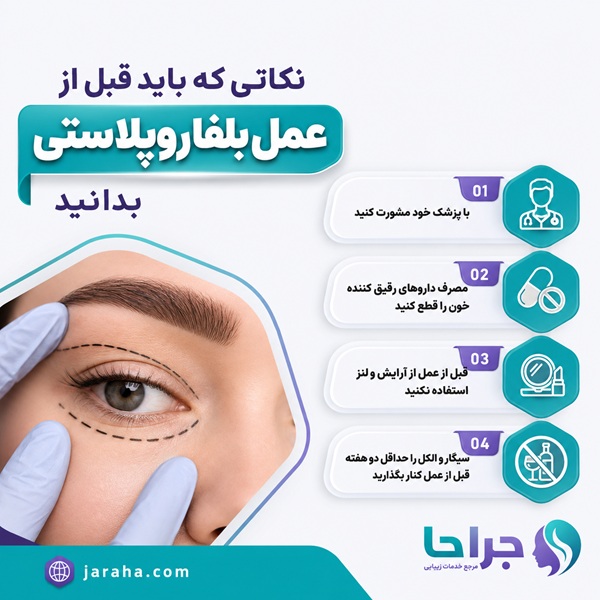 نکاتی که باید قبل از عمل بلفاروپلاستی بدانید