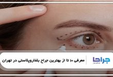 بهترین جراح بلفاروپلاستی در تهران