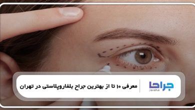 بهترین جراح بلفاروپلاستی در تهران